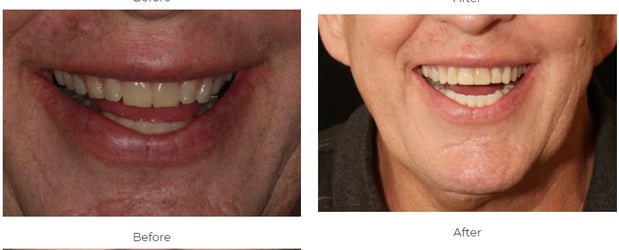 Images Aspen Ridge Dental