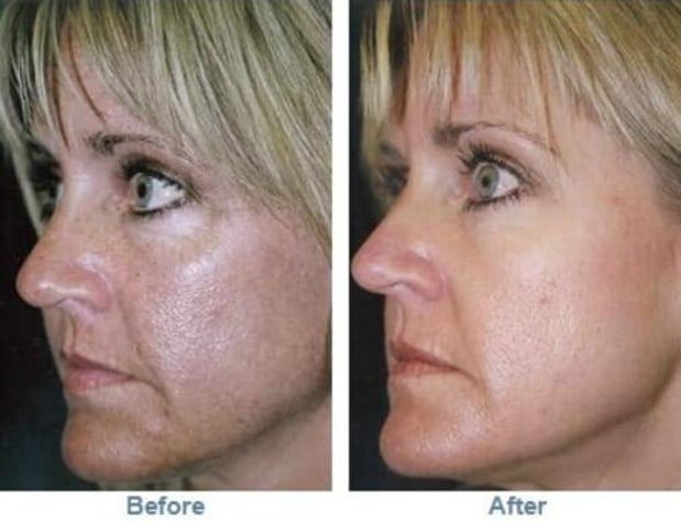 Images Hollywood Body & Face Denver/Metro