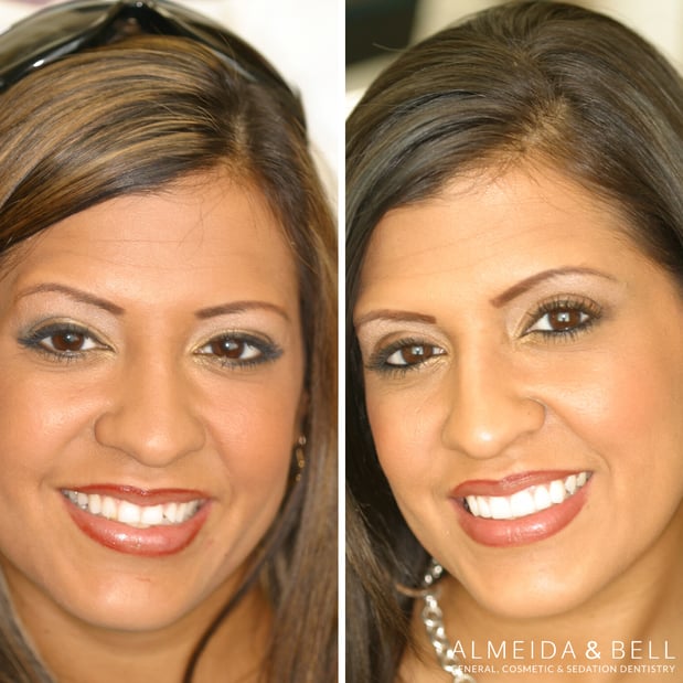 Images Almeida & Bell Dental Lone Tree - General, Cosmetic, and Implant Dentistry
