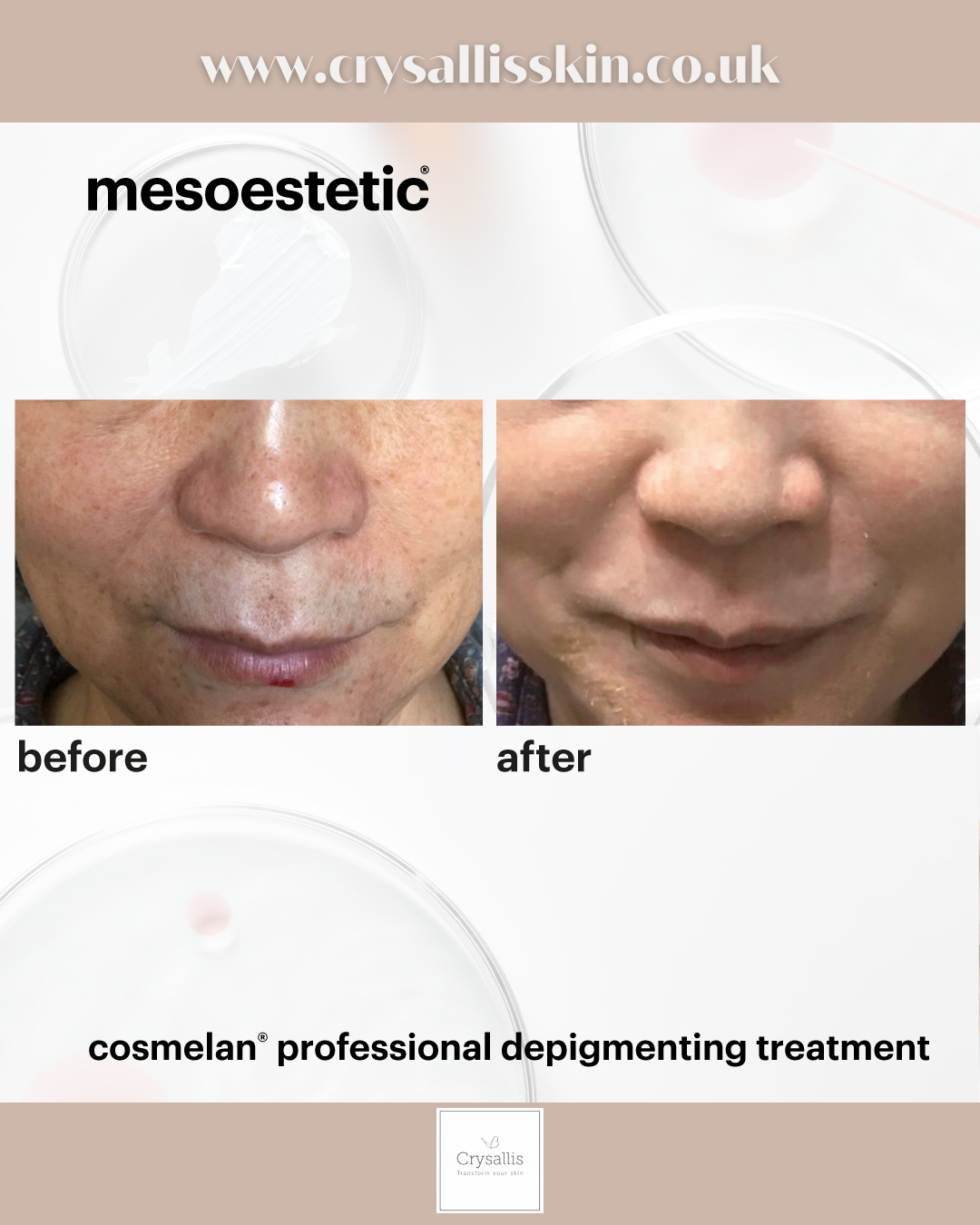 Images Crysallis Skin Clinic