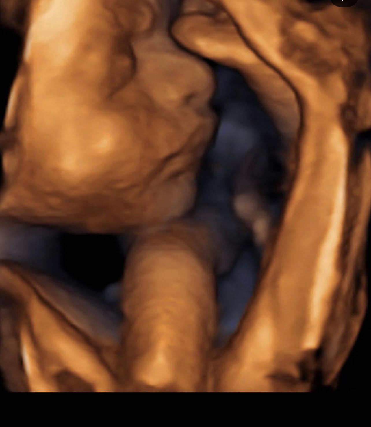 Image 10 | Belly 2 Birth 3D 4D Ultrasound