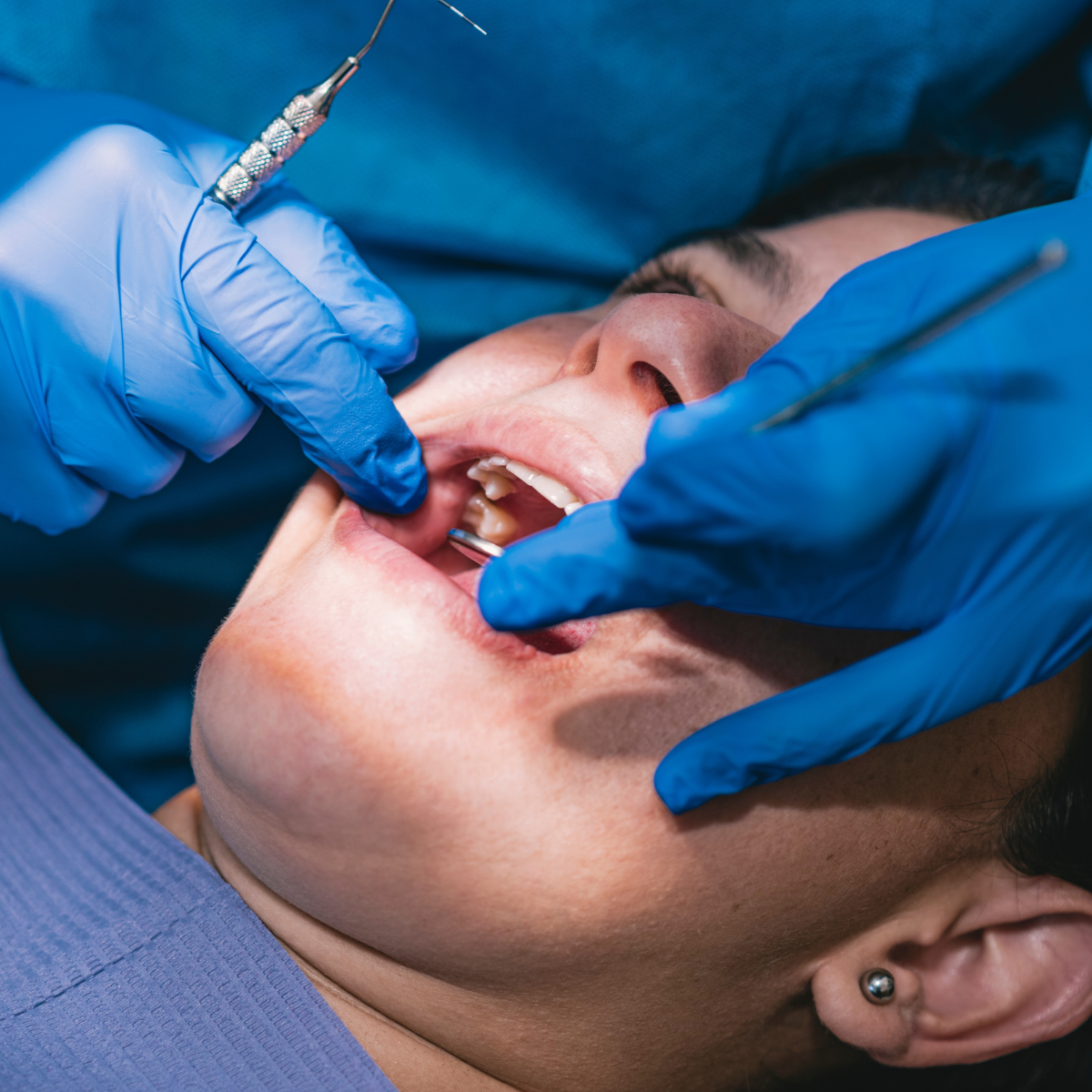 Chino Hills Oral Surgery Image
