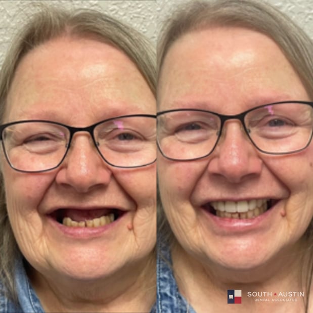 Images South Austin Dental Associates