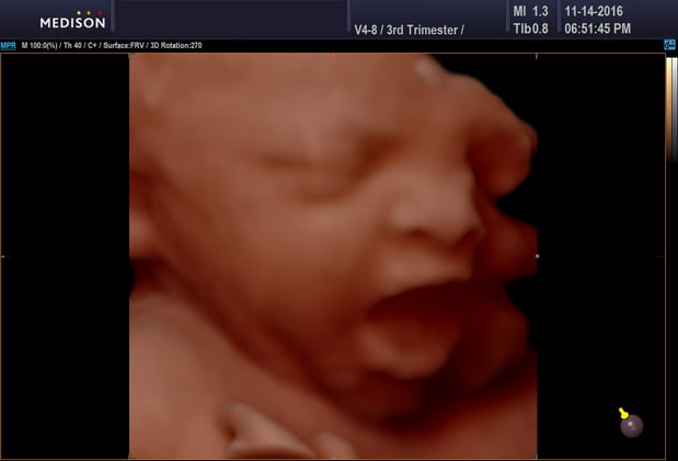 Images Heavenly 3D 4D Ultrasounds