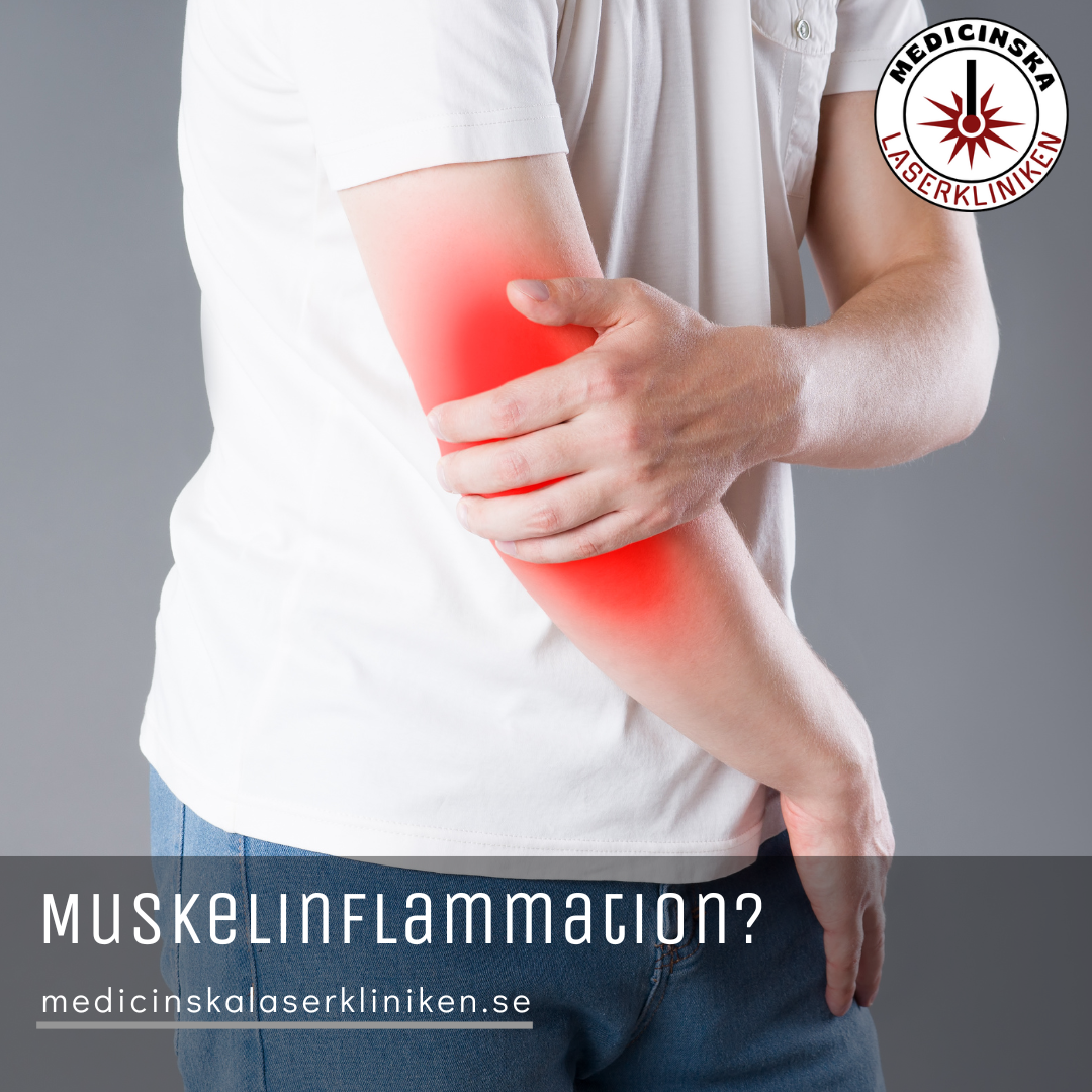 Images Medicinska Laserkliniken