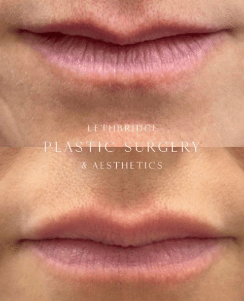 Images Lethbridge Plastic Surgery & Aesthetics