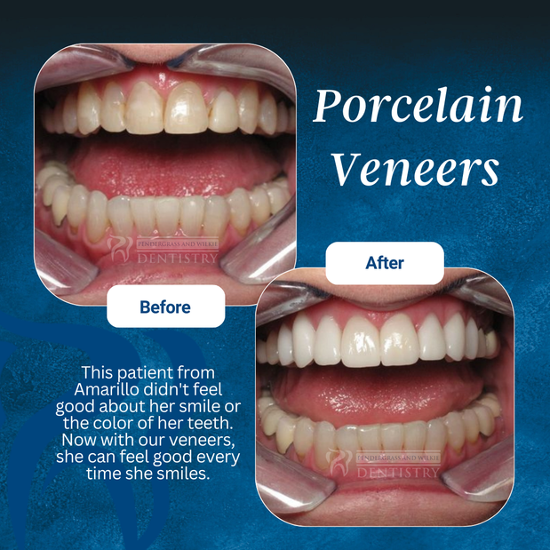 Images Pendergrass and Wilkie Dentistry