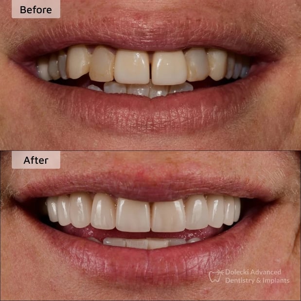 Images Dolecki Advanced Dentistry & Implants