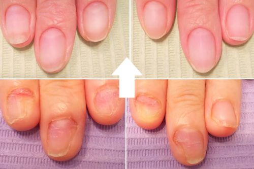 Images アールクイーンネイル（R.QueenNail）