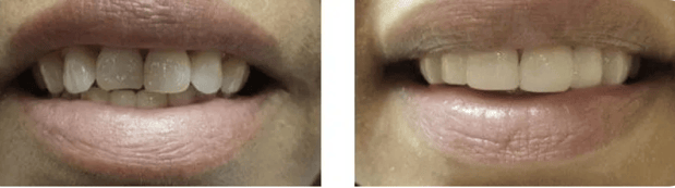 Images Allen Dentistry