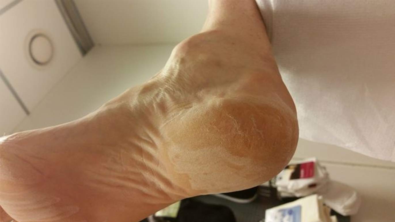 Images Kongsberg Fotterapi AS