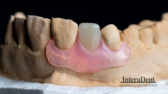 Images Hammaslaboratorio InteraDent