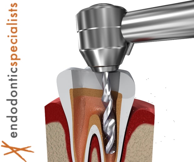 Images Tyler F Baker, DDS MS - Endodontic Specialists