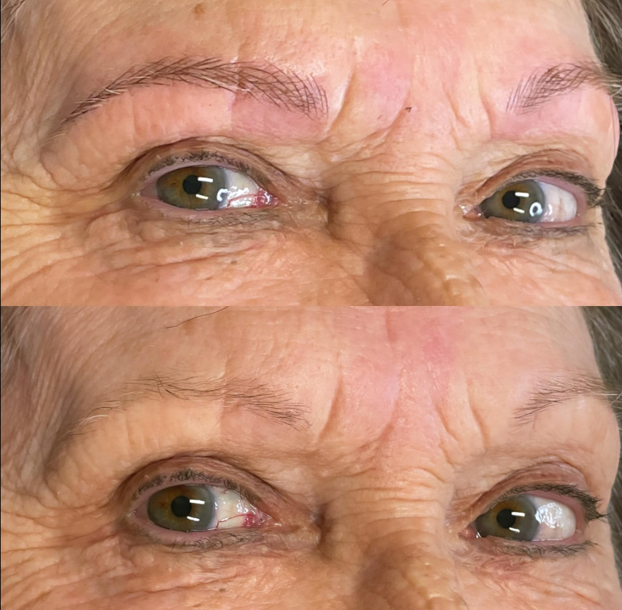 Images Clinique d'Esthétique Leila - Hydrafacial, Microblading, Épilation Laser Sainte-Foy