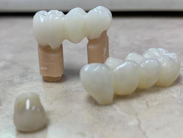 Images South Shreveport Dental