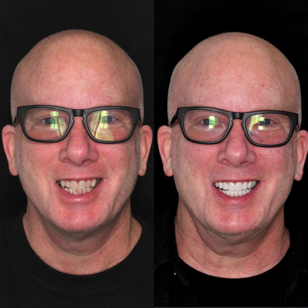 Images Nashville Wisdom Teeth and Implant Solutions