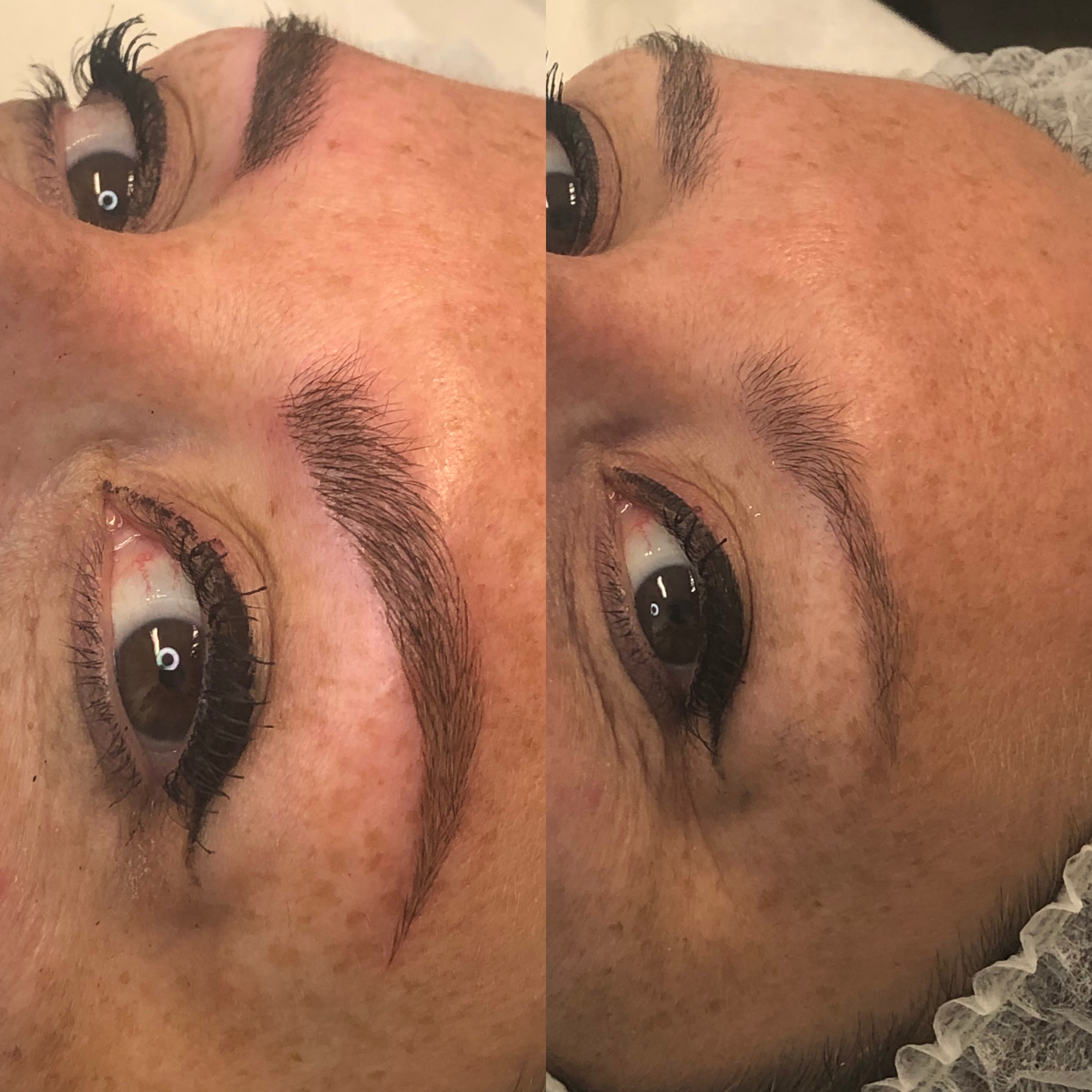 Images Clinique d'Esthétique Leila - Hydrafacial, Microblading, Épilation Laser Sainte-Foy