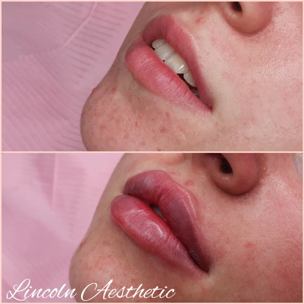 Images Lincoln Aesthetic