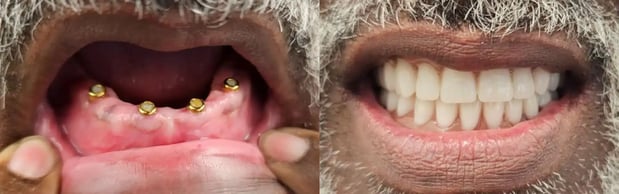 Images Twin Branch Dental