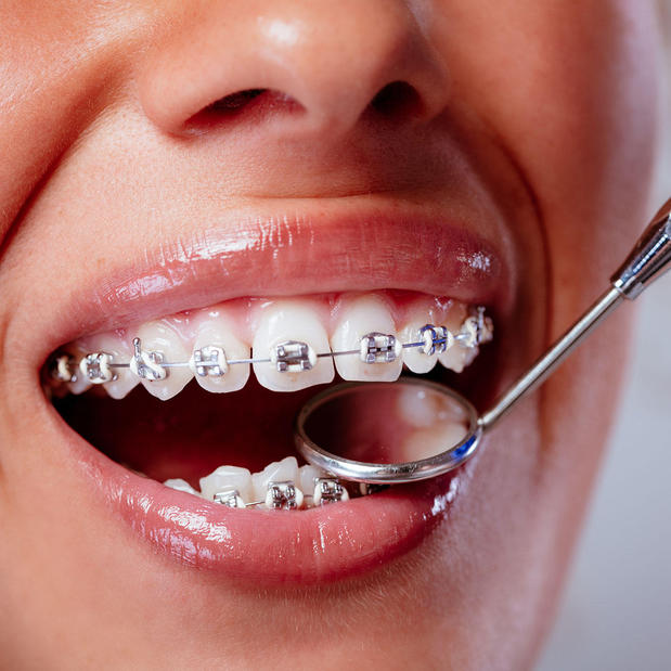 Images Elite Pediatric Dentistry – Fairfax