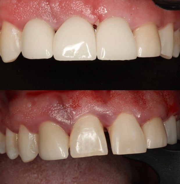 Images Queensboro Oral Surgery & Associates