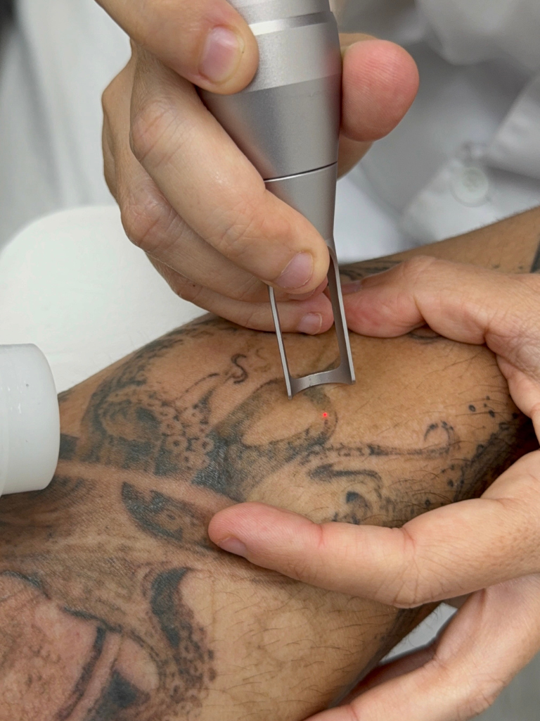 Images Dra. Silvia Solà. Medicina Estética y Láser