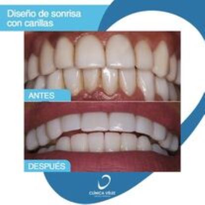 Images Clínica Dental y Estética Vélez
