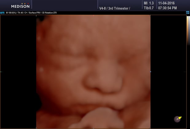 Images Heavenly 3D 4D Ultrasounds
