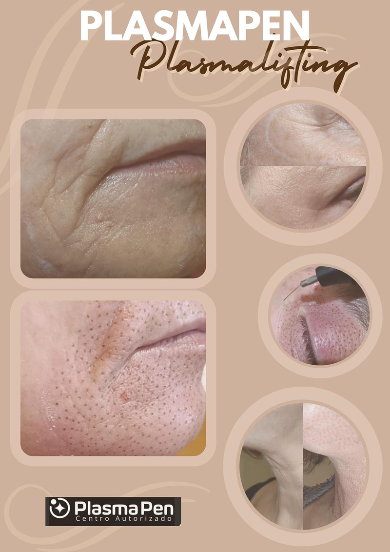 Images Centro De Estética Avanzada Y Láser Verónica Vico