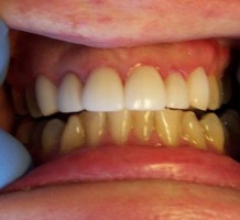Images Complete Family Dental