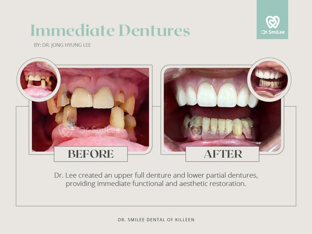Images Dr Smilee Dental of Killeen, Family, Cosmetic, Implant, Medspa