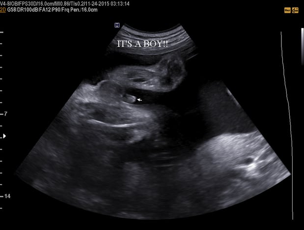 Images Heavenly 3D 4D Ultrasounds-Upland