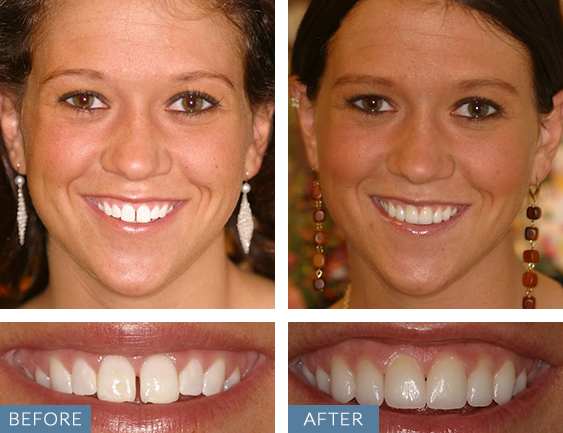 Images Almeida & Bell Dental Lone Tree - General, Cosmetic, and Implant Dentistry