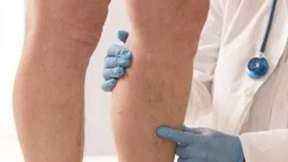 Images Dr. Alejandro Nuricumbo Vázquez