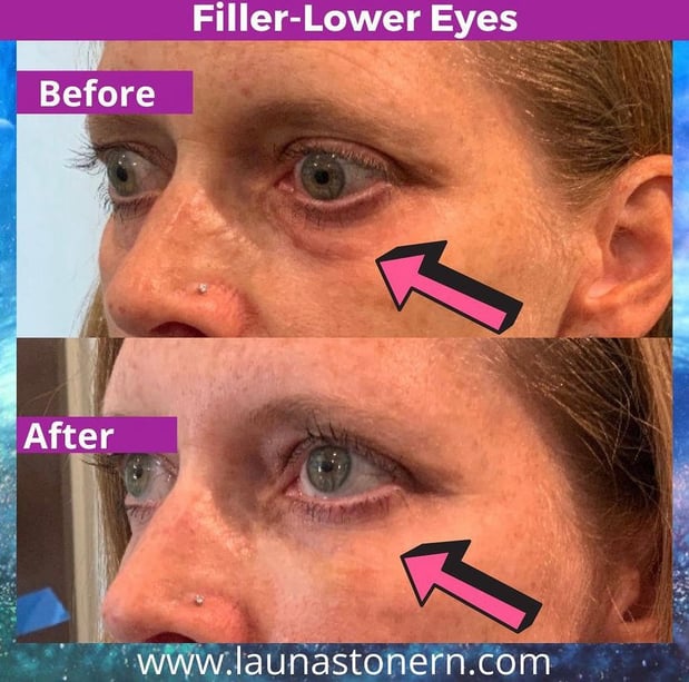 Images Launa Stone, R.N.