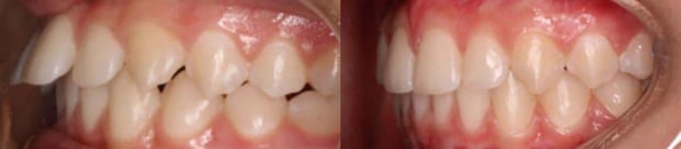 Images TLC Pediatric Dentistry and Orthodontics