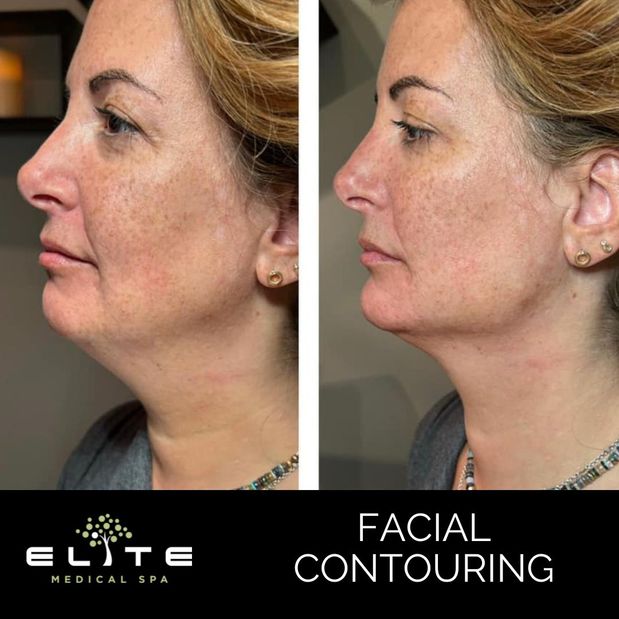 Images Elite Medical Spa of Sarasota