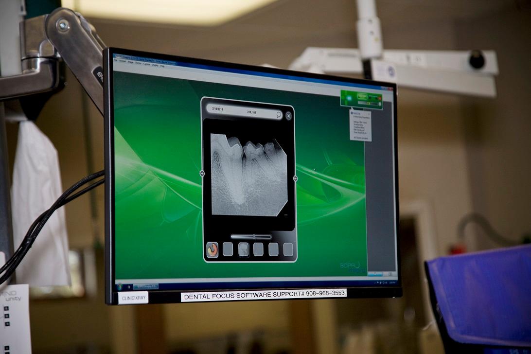More than half of the teeth are below the gum line, so it's not surprising that most dental disease is found below the gum line too! To make up for what cannot be seen during a visual exam, we’ve invested in advanced digital dental x-ray technology.