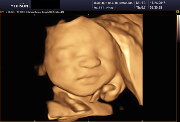 Images Heavenly 3D 4D Ultrasounds-Upland