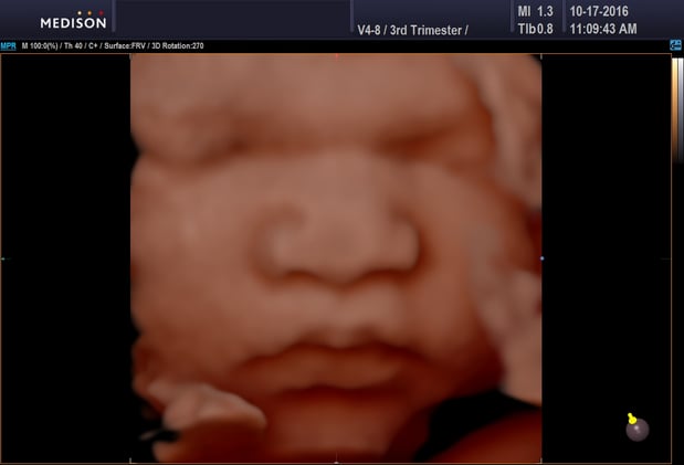 Images Heavenly 3D 4D Ultrasounds