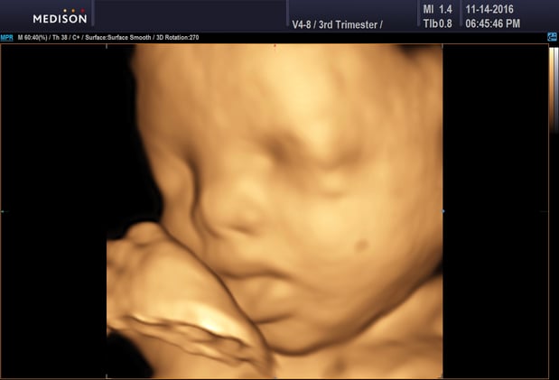 Images Heavenly 3D 4D Ultrasounds