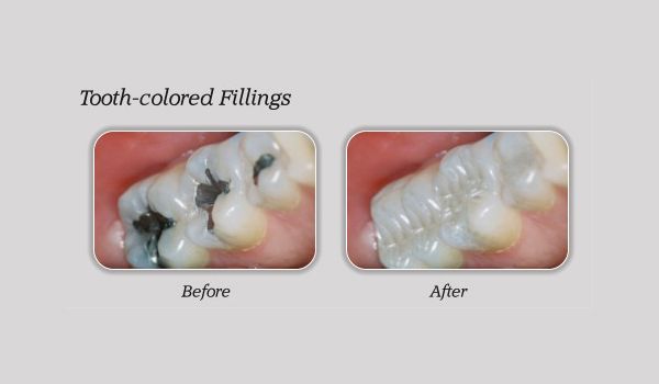 Images Smile Maker Implant & General Dentistry