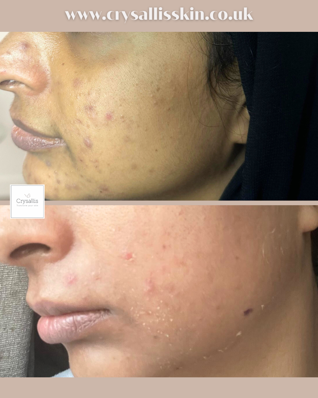 Images Crysallis Skin Clinic