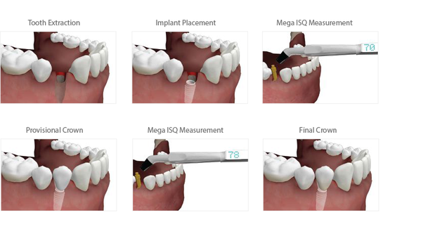 Images Elevated Oral & Implant Surgery, P.C.