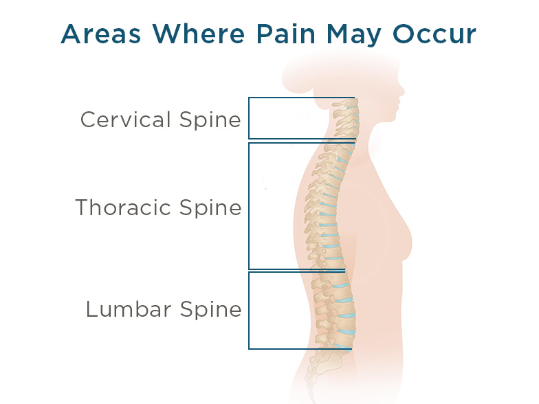 Cncrns_Cndtns-backpain-chart-392x294_@2x.jpg