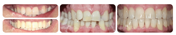 Images Aspire Dental Care PLLC