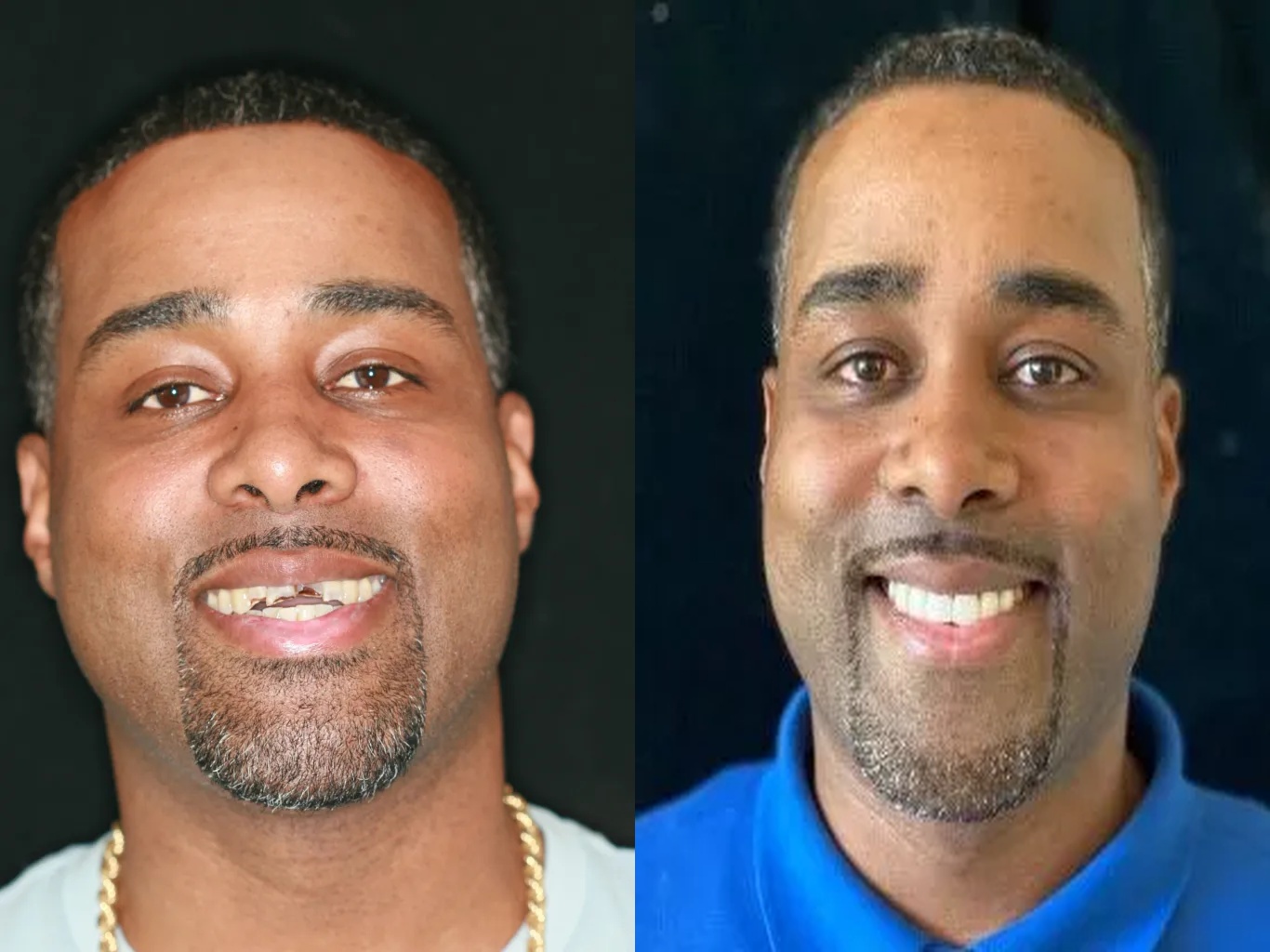 Bosler Implant & Cosmetic Dentistry Image