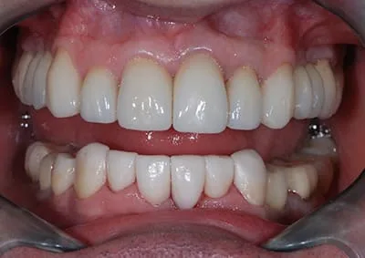 Images Smile Dental Laboratory