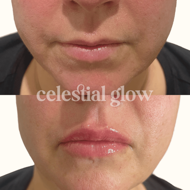 Images Celestial Glow Aesthetics Clinic