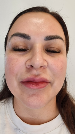 Images Obtain Confidence | Med Spa